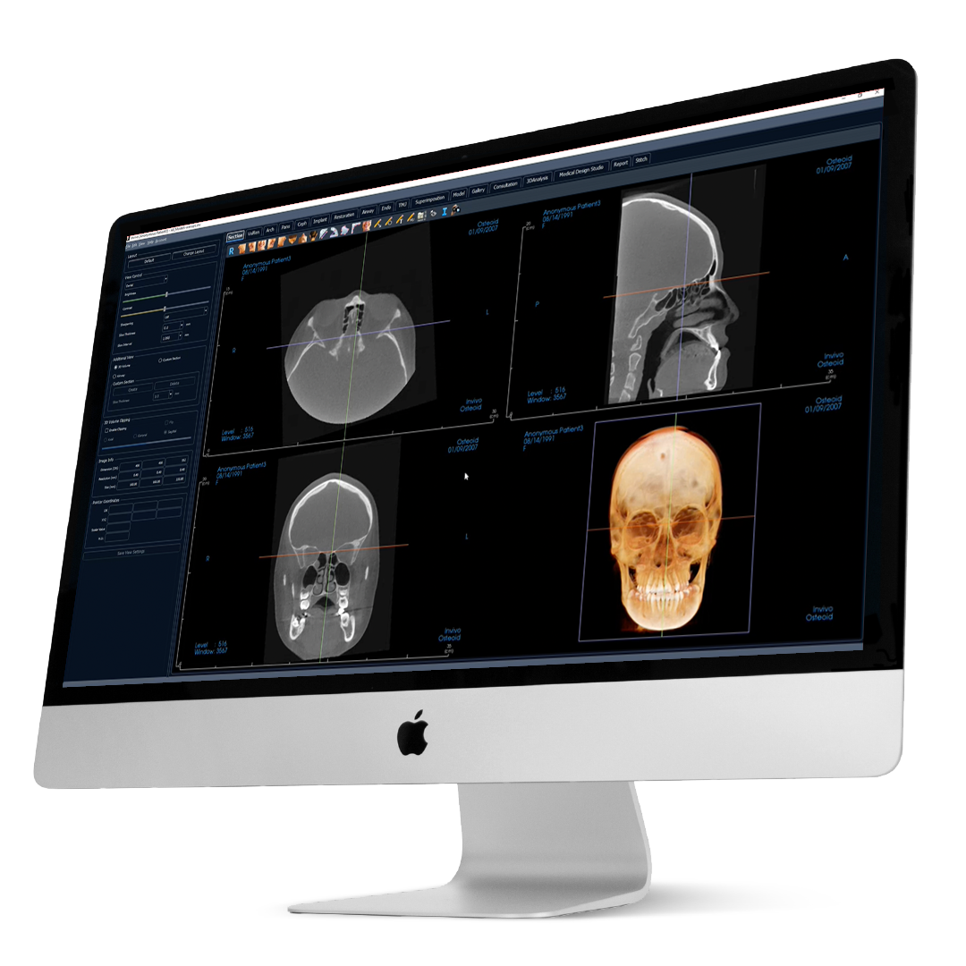 Invivo_7.1_Computer