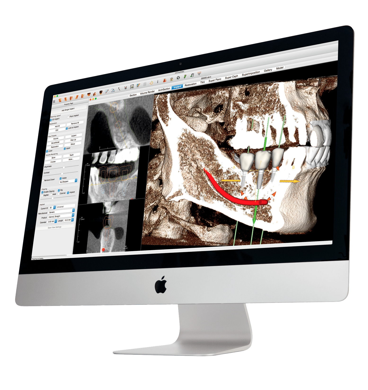 invivo6_mac_screen